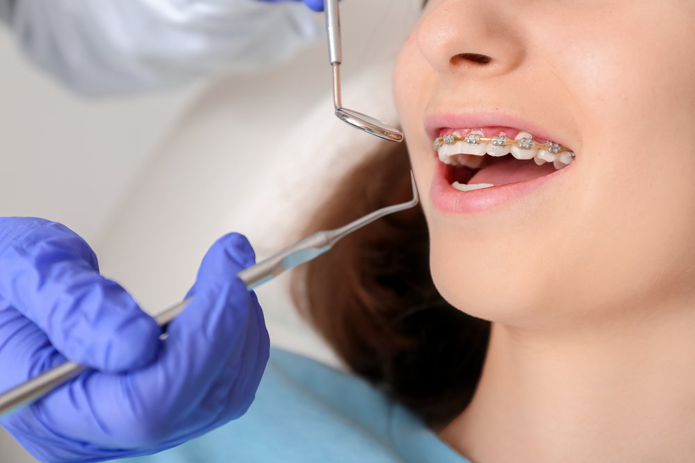 Teenage,Girl,With,Dental,Braces,Visiting,Orthodontist,In,Clinic